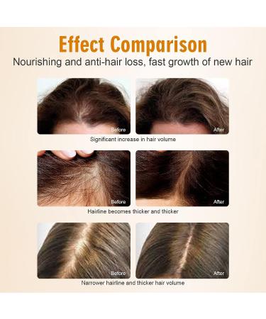 Hair Growth Serum with Tumeric for Women & Men - 2oz | Strengthens, Thickens, and Nourishes Hair | Fast Results for Split Ends & Dry Scalp - Buy Online on GoSupps.com