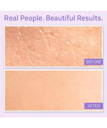 YEOUTH Hyaluronic Acid Moisturizer Cream with Vitamin C - Hydrating Face Cream for Dull & Dry Skin | 1oz - Buy Online on GoSupps.com