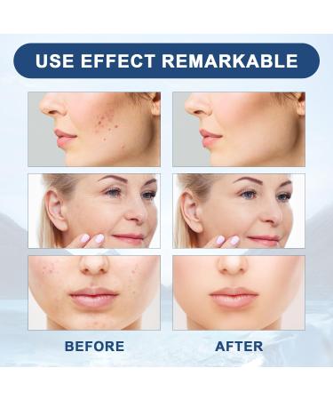 2PCS Botox Face Serum - Anti-Wrinkle Moisturizing Solution with Aloe Vitamin C & E 30ML - Buy Online on GoSupps.com