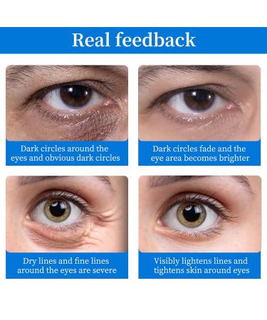 Brightening Under Eye Patches (64 pcs) - Hydrating Hyaluronic Acid Masks for Puffy Eyes Dark Circles & Wrinkle Reduction - Cooling Eye Care Solution - Buy Online on GoSupps.com