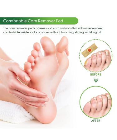 24 Pack Corn Removers for Feet - Large and Small Size Toe Corn Callus Removal - Foot Corn Remover for Toes - 24 Count - Buy Online on GoSupps.com
