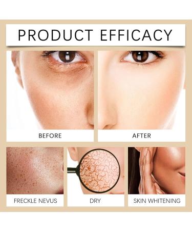 Melanin Correcting Cream Spot Cream For Melanin Correcting Melanin Correcting Body Cream Freckle Removal Cream Dark Spot Remover For Face Dark Spot Corrector Stick For Body Knees Neck Armpit - Buy Online on GoSupps.com