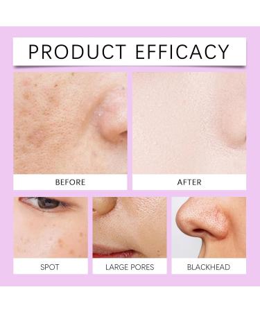 Essence anti-hyperpigmentation avanc e s rum anti-pigmentation pour corriger les taches r duit l'hyperpigmentation pour unifier le teint et am liorer les pores hydratant et claircissant (1pcs) - Buy Online on GoSupps.com