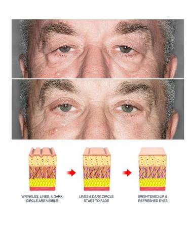 Open Eyes Peptide Gel Set - Awaken Lifting & Firming Eye Gel for Women/Men - Buy Online on GoSupps.com