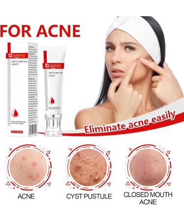 Waymaytecy 25g antiblemish gel for face antipimple gel oil control and hydration lighten acne spots and pimples suitable for men and women white - Buy Online on GoSupps.com