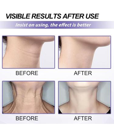 Neck Tightening Cream Duo - Firming & Lifting Sagging Skin, Reduce Wrinkles & Fine Lines - 40g x 2 - Buy Online on GoSupps.com
