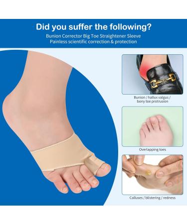 Bunion Corrector Big Toe Separator & Splint Sleeve - 1 Pair with Silicone Pad for Day and Night Wear - Small Beige - Buy Online on GoSupps.com