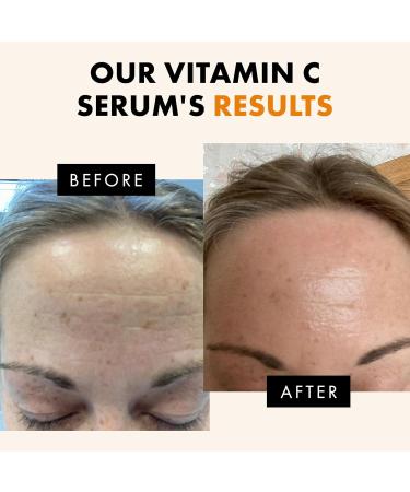 Eclat Skincare Vitamin C Serum + Clarifying Niacinamide Serum Bundle Brightening Hydrating & Anti Aging Duo Dark Spot Reduction Pore Refining & Skin Radiance 2 x 1 Fl Oz - Buy Online on GoSupps.com