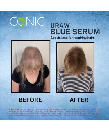 URAW Blue Serum 100ml - Effective Hair Growth & Anti-Hair Loss Serum | New Bottle for International Shipping - Buy Online on GoSupps.com