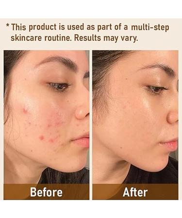 4 In 1 Foundation Liquid- Hydrating Medium Full Coverage Concealer with SPF 50+ Forever Bloom Biomimic Foundation 4 In 1 - Light Spectrum Forever Bloom Biomimic Foundation liquid Foundation 2pc - Buy Online on GoSupps.com