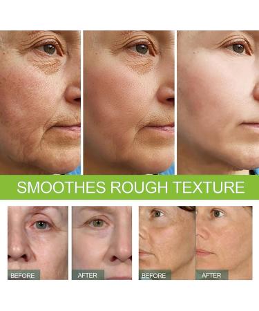 Kojic Acid Face Cream - Moisturiser Face Women - Kojic Acid Skin Lightening Cream for Dark Skin - Moisture Hydrate Smooth Tender Firm - Reduce Body Dullness Dilute Stain - Flawless Anti Freckle Aging - Buy Online on GoSupps.com