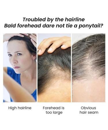 Hair Growth Oil | Jojoba & Wild Oil - Natural Anti-Frizz Density Boost for Men & Women - 30 ml | Aznever - Buy Online on GoSupps.com