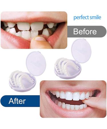 Jiazhou Hub 2 Pairs Prostheses - High-Quality Fake Teeth & Immediate Veneers for a Stunning Smile - Buy Online on GoSupps.com