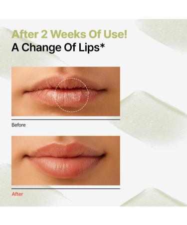 Dr.Different Retinal Lip Balm Clear, Anti-Wrinkle Lip Treatment with Deep Hydration & Long-Lasting Moisture, K-Skincare made by Korean Dermatologist, 0.14oz - Buy Online on GoSupps.com