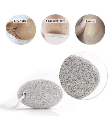 PHOGARY Natural Pumice Stone for Feet 2 PCS - Callus Remover for Hard Skin on Feet and Hands - Lava Pedicure Tool for Exfoliation and Dead Skin Removal - Buy Online on GoSupps.com