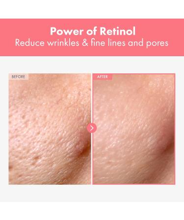 Repair Retinol Cream with Bakuchiol & Niacinamide | Anti-Aging Treatment for Face & Eyes | Korean Skincare 50g - Buy Online on GoSupps.com