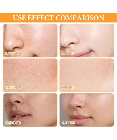 Turmeric Face Wash 100% Organic Turmeric Glow Scrub for Deep Cleaning Remove Makeup Brightens and Firms Skin Helps to Reduce Acne and Dark Spots(100ml) - Buy Online on GoSupps.com