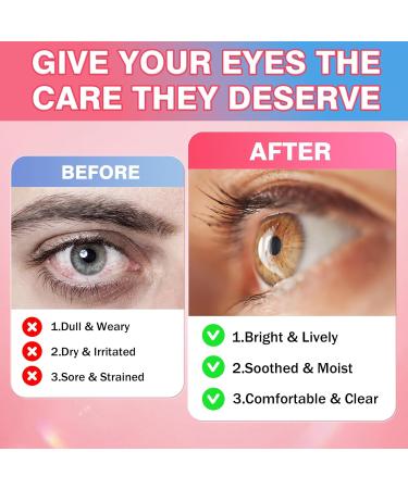 Areds 2 + Advanced Formula for Macular Health, 22-in-1 Eye Vitamin & Mineral Supplement w. Zeaxanthin, Zinc & Vitamin C Supports Eye Strain, Pressure, Night Vision, 60 Chewable Gummies - Buy Online on GoSupps.com