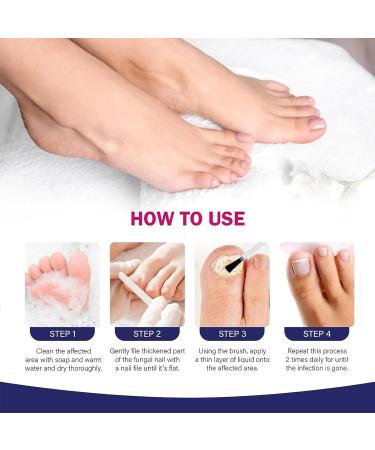 Fungal Nail Treatment - Extra Strong Nail Fungus Treatment for Toenail - Toenail Fungus Treatment for Thickening - Anti Fungus Nail Repair and Strengthen Fix Damaged - Buy Online on GoSupps.com