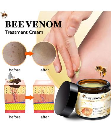 LXCJZY Bee Venom Cream Professional Bee Venom Repair Cream Professional Bee Venom Correcting Gel Bee Venom Mole and Wart Treatment Cream for All Parts of The Body (3pcs) - Buy Online on GoSupps.com