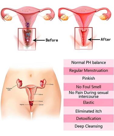 Anniecare Natural Repair Vaginal Capsule | Instant Anti-Itch & Tighten | 4PCS - Buy Online on GoSupps.com