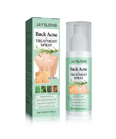 Back Acne Treatment Spray Body Acne Spray Herbaluxy Back Acne Spray 2% Salicylic Acid Spray with Herbal Formula Back Acne Treatment