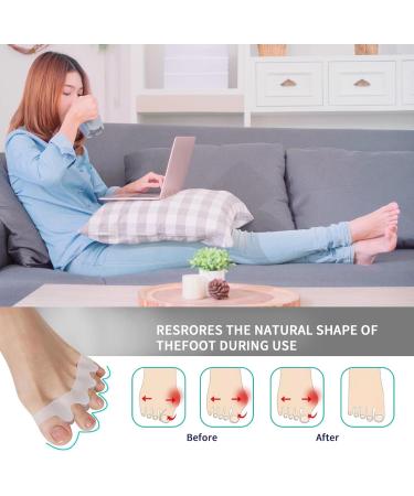 Silicone Toe Separators (2 Pair) - Toe Straighteners and Spacers for Curled, Overlapping Toes - Toe Stretcher for Toe Relief and Foot Restoration - White - Buy Online on GoSupps.com
