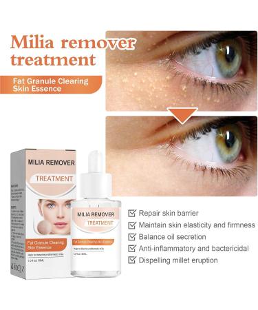 Fat Granule Clearing Skin Essence Milia Clearing Essence Milia Remover Serum Organic Skin Spot Purifying Serum Milia Spot Removal Treatment Helps Dissolve and Reduce Milia - Buy Online on GoSupps.com