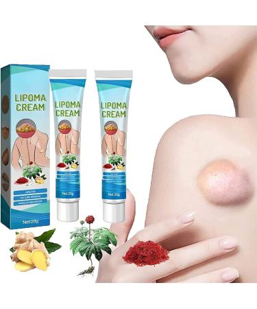 Lipoma Removal Cream Cr me d' limination de lipomes Cellulite Removal Exfoliating Cream Get Rid of Your Fatty Lipoma Lumps (2pcs)