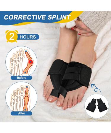 Libershine Hallux Valgus Correction 6-in-1 Set | Bunion Corrector & Day/Night Support - Buy Online on GoSupps.com