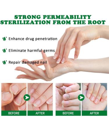 Organic Nail Growth Oil 60ml Portable Strengthener Professional Cuticle Care Solution Toenail Repair Liquid Repairing and Thickening Formula for Healthy Nails - Buy Online on GoSupps.com