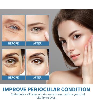 Zetiling 8 Pack Reusable Ice Gel Eye Pads - Hot Cold Eye Masks for Puffy Eyes Deep Hydration & Anti-Aging Effects - Shop Internationally - Buy Online on GoSupps.com