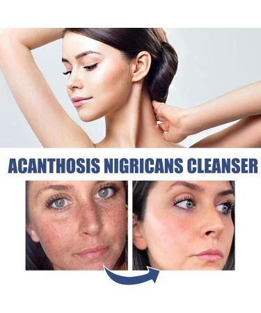 JOYVOIDX Facial Cleansing Lotion with Grapefruit Extract Tea Tree Oil and Azelaic Acid Breakout and Pore Care Formula for Skin Cleansing and Barrier Support Purifying and Soothing 1.69 Fl Oz - Buy Online on GoSupps.com