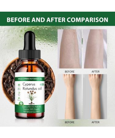 3 x Cyperus Rotundus Oil 100% Natural Cyprus Oil for Hair Removal Reducing Body Hair Growth Smooth Skin Moisturizing & Soothing Ideal for Men & Women 60 ml - Buy Online on GoSupps.com