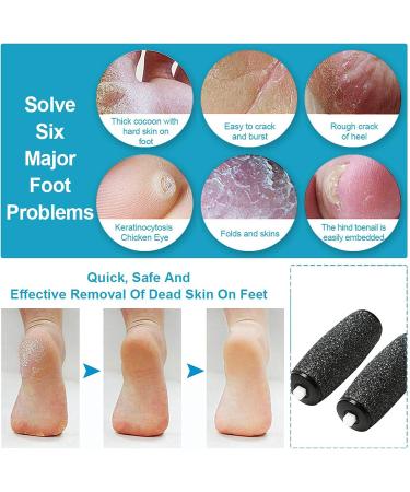 Pack of 9 Replacement Rollers for Electric Callus Remover - Ultimate Foot Care Tool for Smooth Healthy Feet | International Shipping Available - Buy Online on GoSupps.com