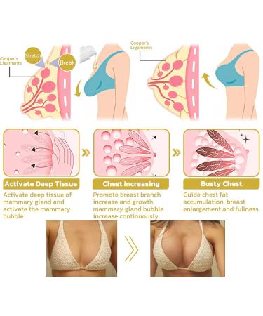 Moondor Firming & Renewal Cream, Moondor Firming Lotion, Moondor Skin Firming Cream, Deep Hydration, Skin Firming Rejuvenation for All Skin Types (1 Bottle) - Buy Online on GoSupps.com