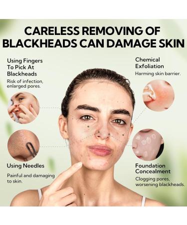  LANBENA LANBENA 60 Pcs Bamboo Charcoal Pore Strips (30g) with Blackhead Puller Black Head Puller Blackhead Remover Kit Blackhead Reshifting Kit Nose Strips for Blackhead - Buy Online on GoSupps.com