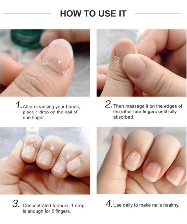 Generic Huile pour Ongles Adoucissant Nutritionnel pour les Doigts Soins pour Manucure Huiles pour Cuticules - Buy Online on GoSupps.com