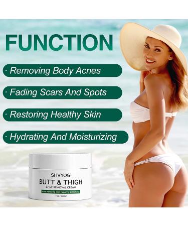 Acne Treatment Cream for Butt & Thigh - Removes Pimples, Ingrown Hairs - Spot & Cystic Acne Treatment - Moisturizes and Repairs Skin - Buy Online on GoSupps.com