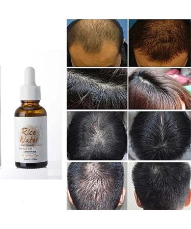 Puraect Fermented Rice Water Serum for Hair Growth - Biotin Hair Loss Solution | Thinning Hair Treatment (1 PC) - Buy Online on GoSupps.com
