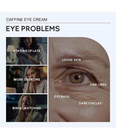 5% Caffeine Eye Cream For Dark Circles And Puffy Eyes Tea Polyphenol For Eye Cream Anti Aging Lifting & Hydrated For Under Eye Cream Dark Circle Eye Cream Caffeine Eye Bag Cream 30ML - Buy Online on GoSupps.com