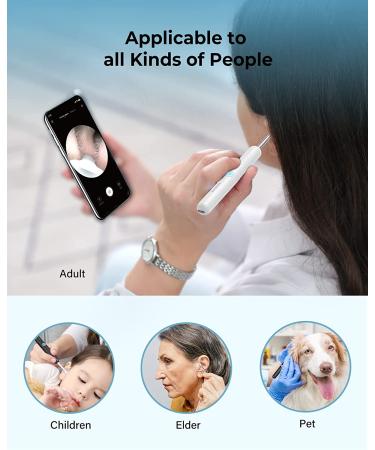 Bebird 1080P HD Wireless Ear Wax Removal Camera Tool with 6 LED Lights - Compatible with iPhone, Android - Safe for Kids & Adults - White - Buy Online on GoSupps.com