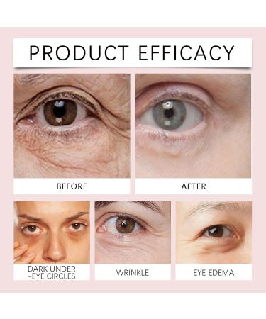 Real-Eyez-Ation Tinted Firming Eye Gel Traittion Eye Gel Realeyezation Eye Cream Instant & Temporary Under Eyes Tightener Cream (3pcs Unisex) - Buy Online on GoSupps.com