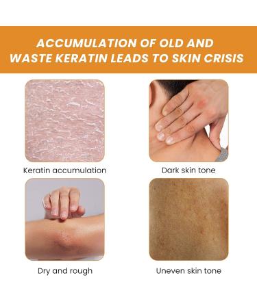 Deep Cleaning Exfoliating Gel for Face & Body | Gentle Peeling Gel with Salicylic Acid for Whitening & Brightening | Removes Dead Skin & Improves Skin Texture - Buy Online on GoSupps.com