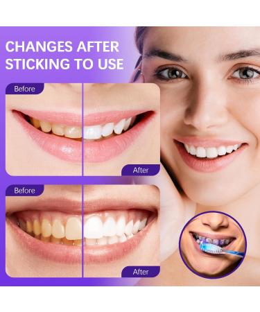 Best Purple Toothpaste for Teeth Whitening | Stain Removal & Smile Enhancement - Buy Online on GoSupps.com