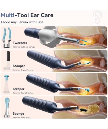 Ear Wax Removal Tool Camera: ZERONDER Ear Cleaner with Flexible Ear Scope - Visual Camera 1080P HD for Adults & Kids - Safe Ear Cleaning Tool for Home Use White - Buy Online on GoSupps.com
