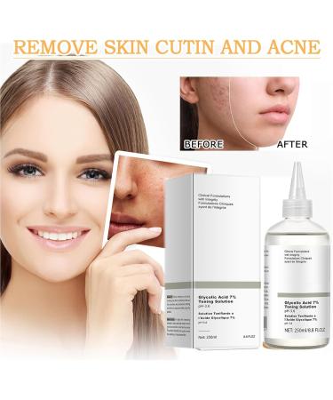 Mikabila 250ml Glycolic Acid 7% Toning Resurfacing Solution Glycolic Acid Toner Moisturize & Strengthen Skin Glycolic Sour 7% Toner Hydrating Toner Rejuvenate Moisturize & Strengthen Your Skin - Buy Online on GoSupps.com