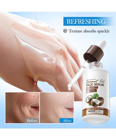 S rum intensif l'huile de coco l'huile de noix de coco - Cr me miracle anti-rides et hydrate - Soin intensif pour peaux s ches - Soin en profondeur pour une peau clatante - Apaise et lisse pour - Buy Online on GoSupps.com
