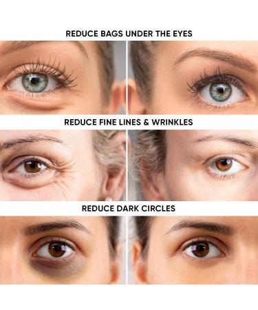 Anti-Aging System Instant Eye Tightener Eye Repair Cream Glycolic Acid 15%. Products in Bundle. Removes Under Eye Bags & Puffiness. Eliminate Dark Circles & Wrinkles. - Buy Online on GoSupps.com