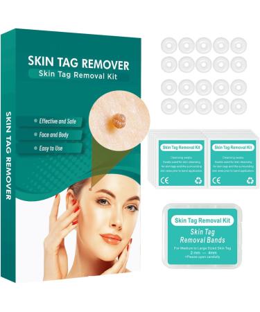 Standard Skin Tag Tool Kit Quick Solution for Medium to Small Skin Tags Complete Skin Tag Tool Kit for Fast Results (2mm-5mm)